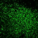 Immunofluorescence - Anti-CD45RO Antibody [UCHL-1] (CF®647) (A352088) - Antibodies.com
