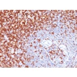 Immunohistochemistry (formalin-fixed, paraffin-embedded) - Anti-CD45RO Antibody [UCHL-1] (CF®647) (A352088) - Antibodies.com