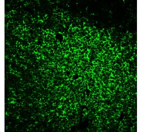 Immunofluorescence - Anti-CD45RO Antibody [UCHL-1] (CF®568) (A352089) - Antibodies.com