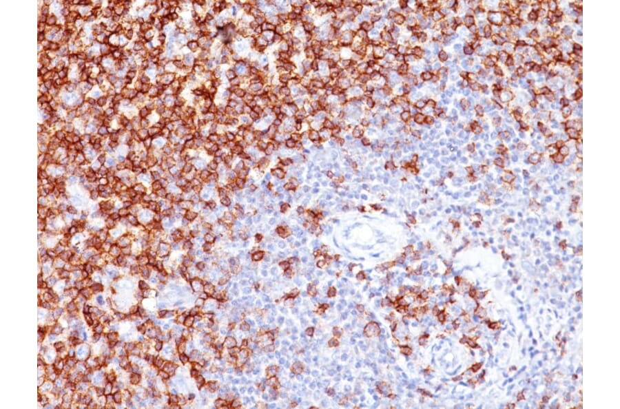 Immunohistochemistry (formalin-fixed, paraffin-embedded) - Anti-CD45RO Antibody [UCHL-1] (CF®568) (A352089) - Antibodies.com