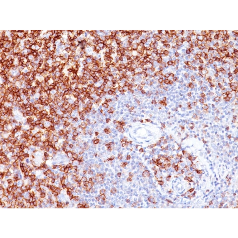 Immunohistochemistry (formalin-fixed, paraffin-embedded) - Anti-CD45RO Antibody [UCHL-1] (Biotin) (A352093) - Antibodies.com