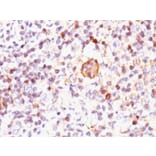 Immunohistochemistry (formalin-fixed, paraffin-embedded) - Anti-Bax Antibody [2D2] (CF®568) (A352097) - Antibodies.com