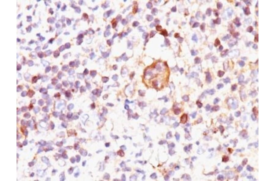 Immunohistochemistry (formalin-fixed, paraffin-embedded) - Anti-Bax Antibody [2D2] (CF®594) (A352100) - Antibodies.com