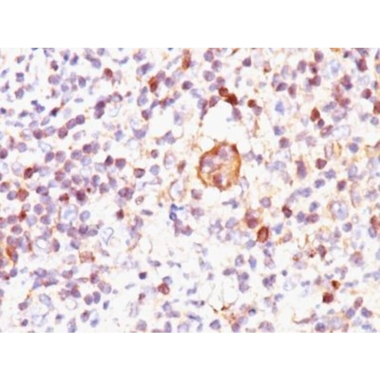 Immunohistochemistry (formalin-fixed, paraffin-embedded) - Anti-Bax Antibody [2D2] (CF®594) (A352100) - Antibodies.com