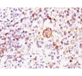 Immunohistochemistry (formalin-fixed, paraffin-embedded) - Anti-Bax Antibody [2D2] (Biotin) (A352101) - Antibodies.com