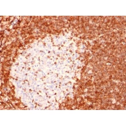 Immunohistochemistry (formalin-fixed, paraffin-embedded) - Anti-Bcl-2 Antibody [8C8] (CF®405M) (A352103) - Antibodies.com