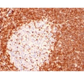 Immunohistochemistry (formalin-fixed, paraffin-embedded) - Anti-Bcl-2 Antibody [8C8] (CF®640R) (A352104) - Antibodies.com