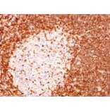Immunohistochemistry (formalin-fixed, paraffin-embedded) - Anti-Bcl-2 Antibody [8C8] (CF®740) (A352107) - Antibodies.com