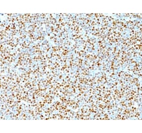 Immunohistochemistry (formalin-fixed, paraffin-embedded) - Anti-Cyclin D1 Antibody [DCS-6] (CF®647) (A352113) - Antibodies.com