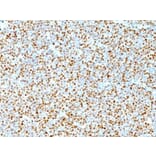 Immunohistochemistry (formalin-fixed, paraffin-embedded) - Anti-Cyclin D1 Antibody [DCS-6] (CF®647) (A352113) - Antibodies.com