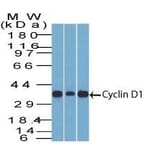 Wstern Blot - Anti-Cyclin D1 Antibody [DCS-6] (CF®740) (A352115) - Antibodies.com