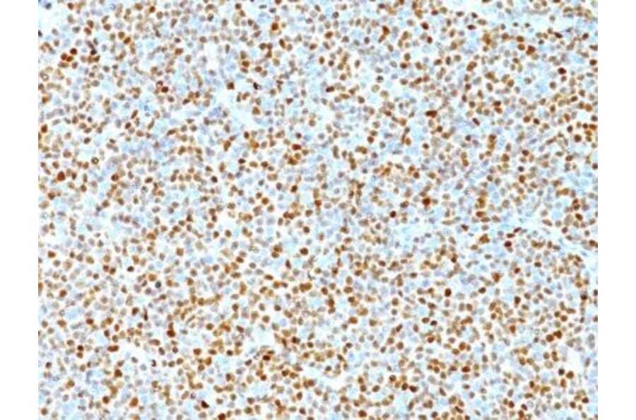Immunohistochemistry (formalin-fixed, paraffin-embedded) - Anti-Cyclin D1 Antibody [DCS-6] (CF®488A) (A352116) - Antibodies.com
