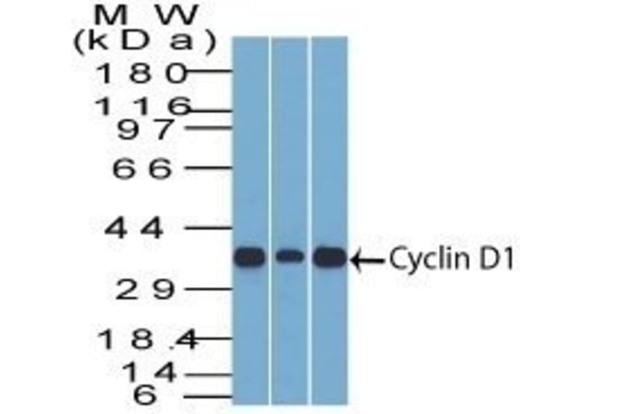 Wstern Blot - Anti-Cyclin D1 Antibody [DCS-6] (CF®488A) (A352116) - Antibodies.com