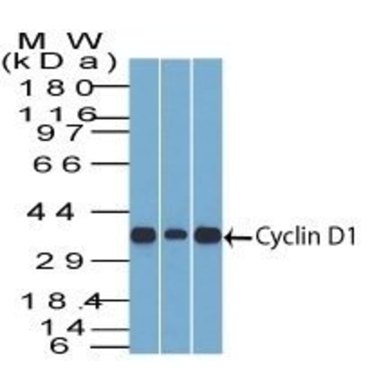 Wstern Blot - Anti-Cyclin D1 Antibody [DCS-6] (CF®594) (A352117) - Antibodies.com