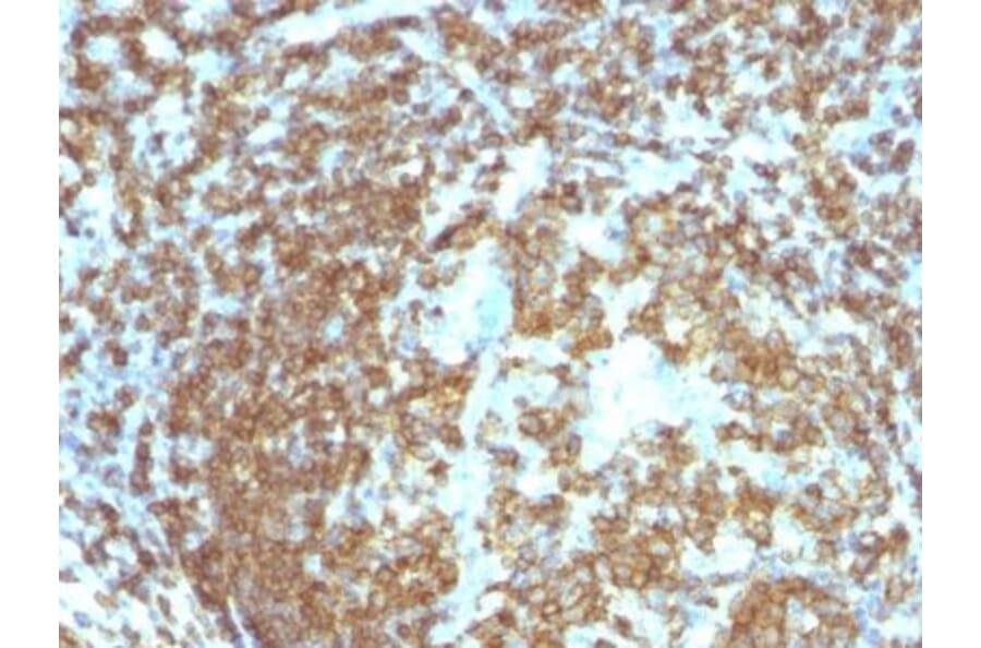 Immunohistochemistry (formalin-fixed, paraffin-embedded) - Anti-CD45RO Antibody [158-4D3] (CF®405S) (A352127) - Antibodies.com