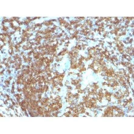 Immunohistochemistry (formalin-fixed, paraffin-embedded) - Anti-CD45RO Antibody [158-4D3] (CF®640R) (A352128) - Antibodies.com