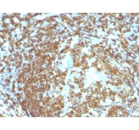 Immunohistochemistry (formalin-fixed, paraffin-embedded) - Anti-CD45RO Antibody [158-4D3] (CF®647) (A352129) - Antibodies.com