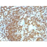 Immunohistochemistry (formalin-fixed, paraffin-embedded) - Anti-CD45RO Antibody [158-4D3] (Biotin) (A352135) - Antibodies.com