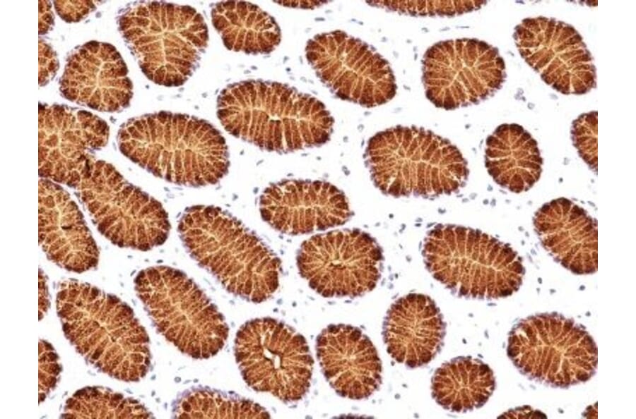 Immunohistochemistry (formalin-fixed, paraffin-embedded) - Anti-MUC5AC Antibody [45M1] (CF®405S) (A352136) - Antibodies.com