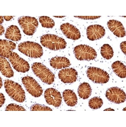 Immunohistochemistry (formalin-fixed, paraffin-embedded) - Anti-MUC5AC Antibody [45M1] (CF®405S) (A352136) - Antibodies.com
