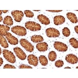 Immunohistochemistry (formalin-fixed, paraffin-embedded) - Anti-MUC5AC Antibody [45M1] (CF®647) (A352138) - Antibodies.com