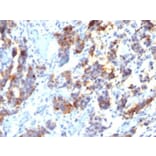 Immunohistochemistry (formalin-fixed, paraffin-embedded) - Anti-MUC5AC Antibody [45M1] (CF®647) (A352138) - Antibodies.com