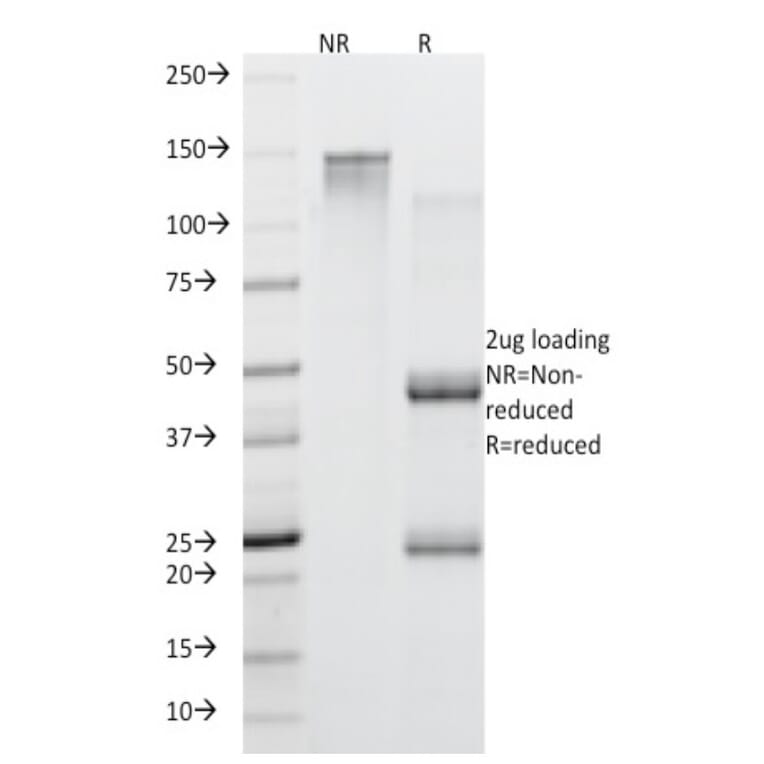 SDS-PAGE - Anti-MUC5AC Antibody [45M1] (CF®568) (A352139) - Antibodies.com