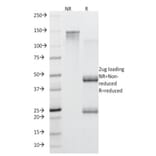 SDS-PAGE - Anti-MUC5AC Antibody [45M1] (CF®740) (A352140) - Antibodies.com