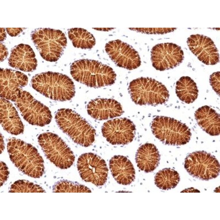 Immunohistochemistry (formalin-fixed, paraffin-embedded) - Anti-MUC5AC Antibody [45M1] (CF®488A) (A352141) - Antibodies.com