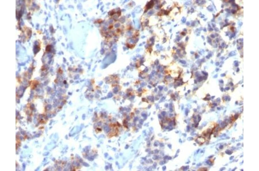 Immunohistochemistry (formalin-fixed, paraffin-embedded) - Anti-MUC5AC Antibody [45M1] (CF®488A) (A352141) - Antibodies.com