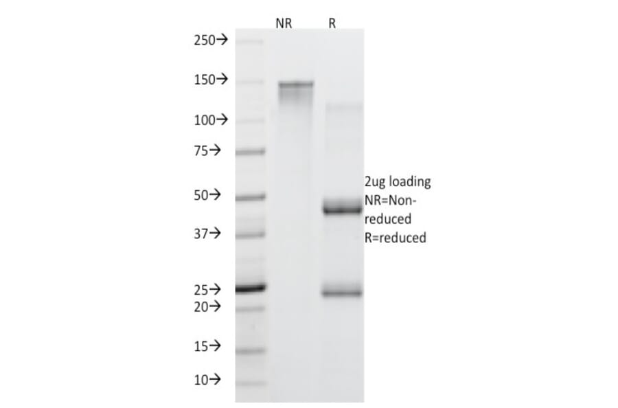 SDS-PAGE - Anti-MUC5AC Antibody [45M1] (CF®488A) (A352141) - Antibodies.com