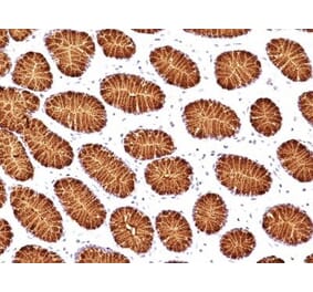 Immunohistochemistry (formalin-fixed, paraffin-embedded) - Anti-MUC5AC Antibody [45M1] (Biotin) (A352143) - Antibodies.com