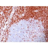 Immunohistochemistry (formalin-fixed, paraffin-embedded) - Anti-Bcl-2 Antibody [100/D5] (CF®640R) (A352154) - Antibodies.com
