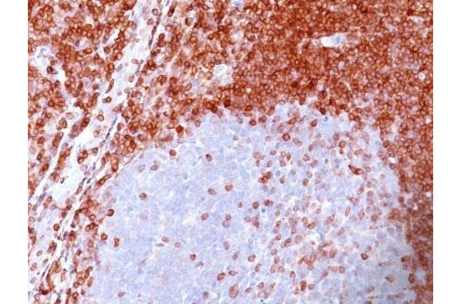 Immunohistochemistry (formalin-fixed, paraffin-embedded) - Anti-Bcl-2 Antibody [100/D5] (CF®647) (A352155) - Antibodies.com