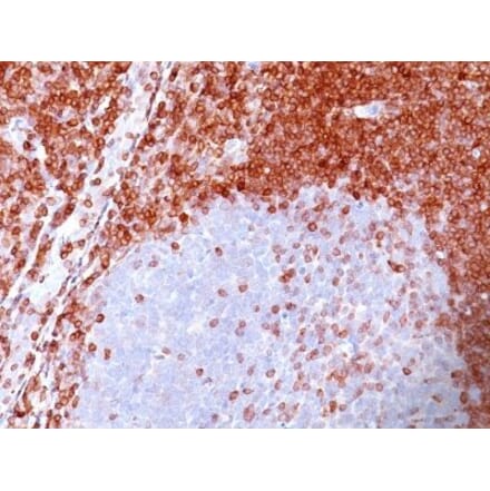 Immunohistochemistry (formalin-fixed, paraffin-embedded) - Anti-Bcl-2 Antibody [100/D5] (CF®647) (A352155) - Antibodies.com