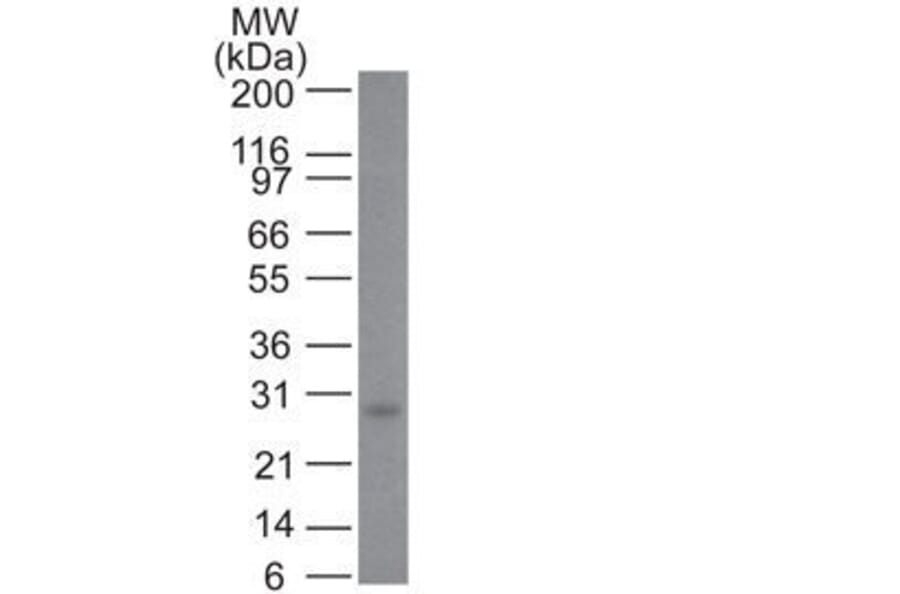Wstern Blot - Anti-Bcl-2 Antibody [100/D5] (CF®647) (A352155) - Antibodies.com