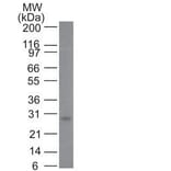 Wstern Blot - Anti-Bcl-2 Antibody [100/D5] (CF®647) (A352155) - Antibodies.com