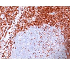 Immunohistochemistry (formalin-fixed, paraffin-embedded) - Anti-Bcl-2 Antibody [100/D5] (CF®568) (A352156) - Antibodies.com