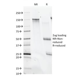 SDS-PAGE - Anti-CD28 Antibody [C28/74] (CF®568) (A352164) - Antibodies.com