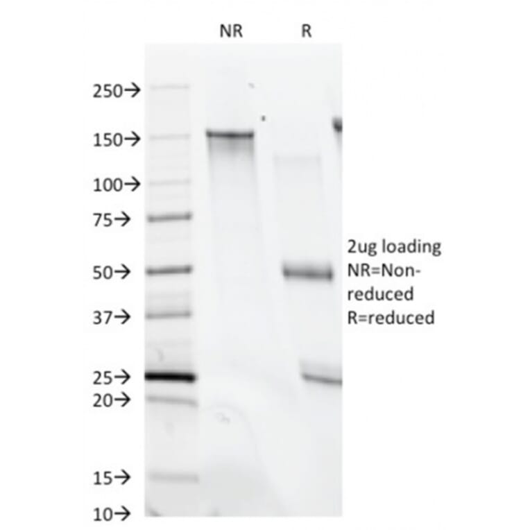 SDS-PAGE - Anti-CD28 Antibody [C28/74] (CF®740) (A352165) - Antibodies.com