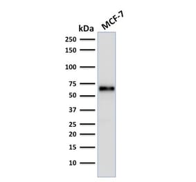 Wstern Blot - Anti-Estrogen Receptor alpha Antibody [ER506] (CF®405S) (A352193) - Antibodies.com