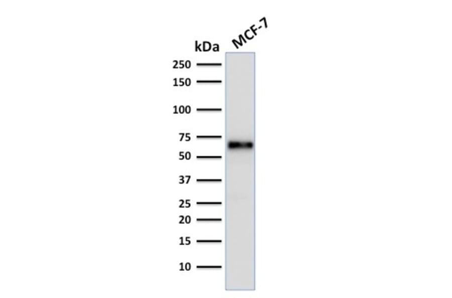 Wstern Blot - Anti-Estrogen Receptor alpha Antibody [ER506] (CF®405S) (A352193) - Antibodies.com