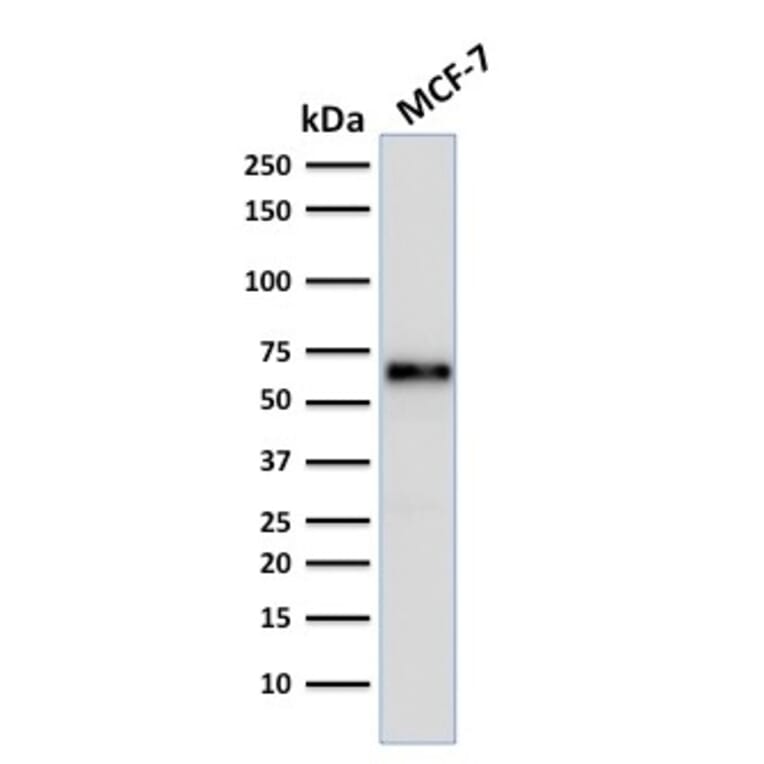 Wstern Blot - Anti-Estrogen Receptor alpha Antibody [ER506] (CF®647) (A352195) - Antibodies.com