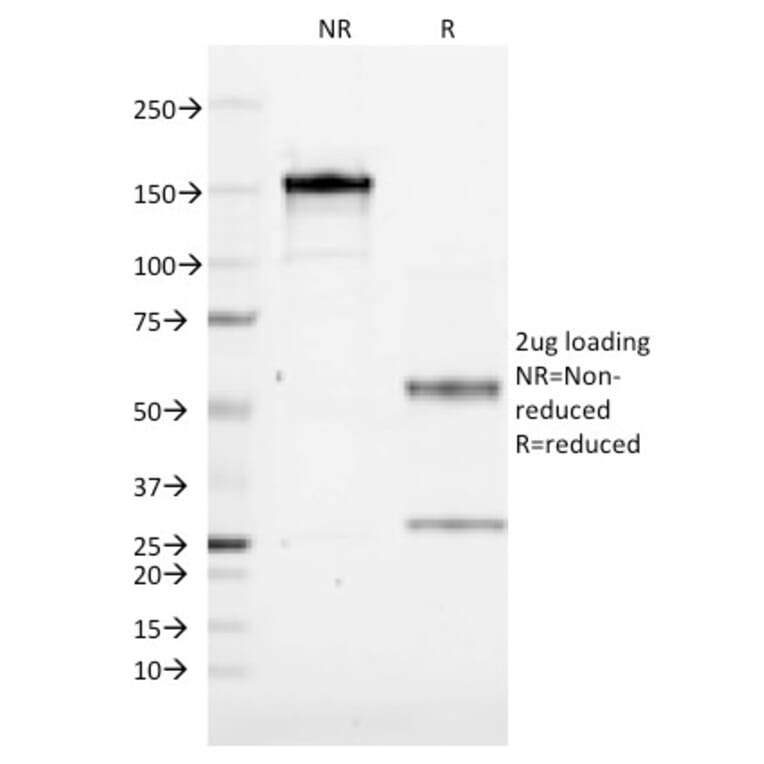 SDS-PAGE - Anti-CD19 Antibody [CVID3/155] (CF®405S) (A352209) - Antibodies.com