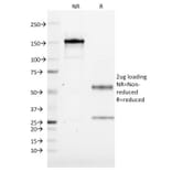 SDS-PAGE - Anti-CD19 Antibody [CVID3/155] (CF®405S) (A352209) - Antibodies.com