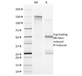 SDS-PAGE - Anti-CD20 Antibody [B9E9] (CF®488A) (A352224) - Antibodies.com