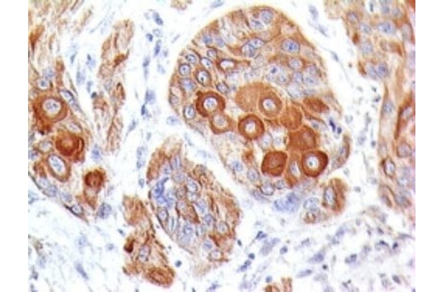 Immunohistochemistry (formalin-fixed, paraffin-embedded) - Anti-CD28 Antibody [204.12] (CF®405S) (A352235) - Antibodies.com