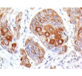 Immunohistochemistry (formalin-fixed, paraffin-embedded) - Anti-CD28 Antibody [204.12] (CF®640R) (A352236) - Antibodies.com