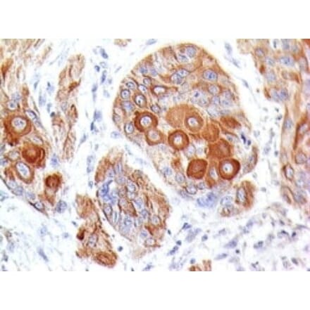 Immunohistochemistry (formalin-fixed, paraffin-embedded) - Anti-CD28 Antibody [204.12] (CF®647) (A352237) - Antibodies.com