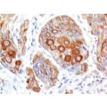 Immunohistochemistry (formalin-fixed, paraffin-embedded) - Anti-CD28 Antibody [204.12] (CF®647) (A352237) - Antibodies.com